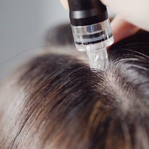 woman getting scalp treatment for a healthier scalp