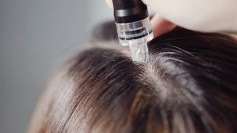 woman getting scalp treatment for a healthier scalp