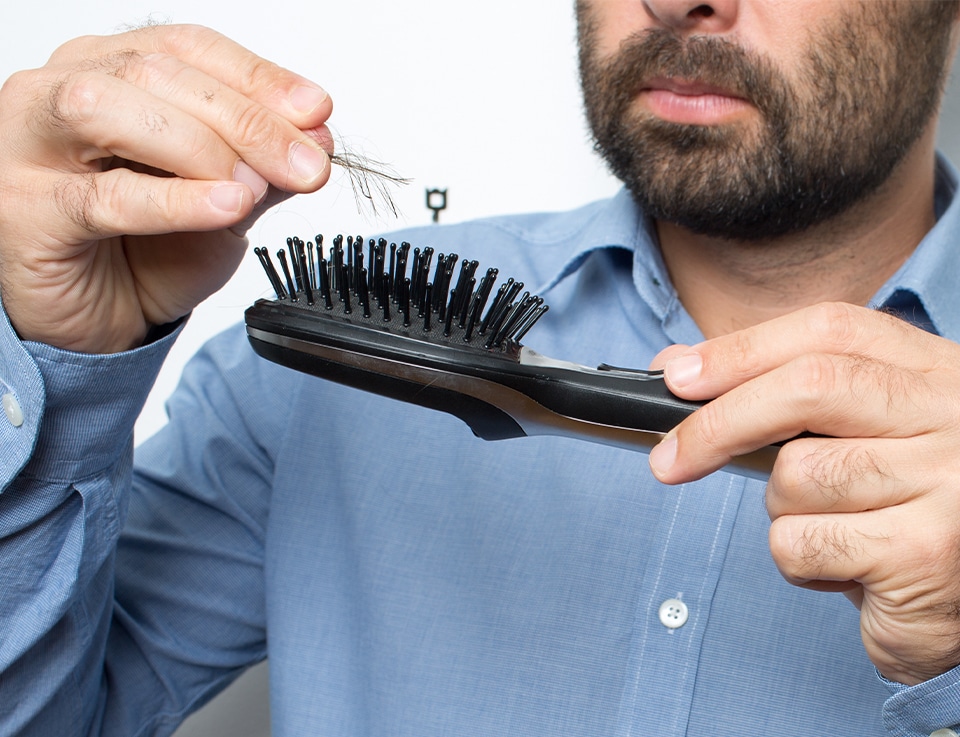 PHS HAIRSCIENCE®️ 10 causes of hair loss for men