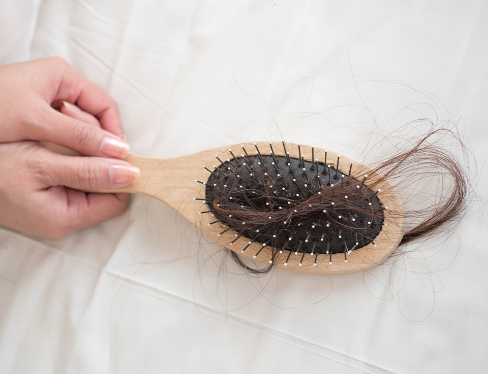 2 Health Conditions That Causes Hair Loss