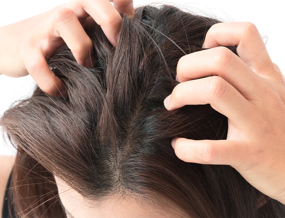Dry And Itchy Scalp: Causes and Cure