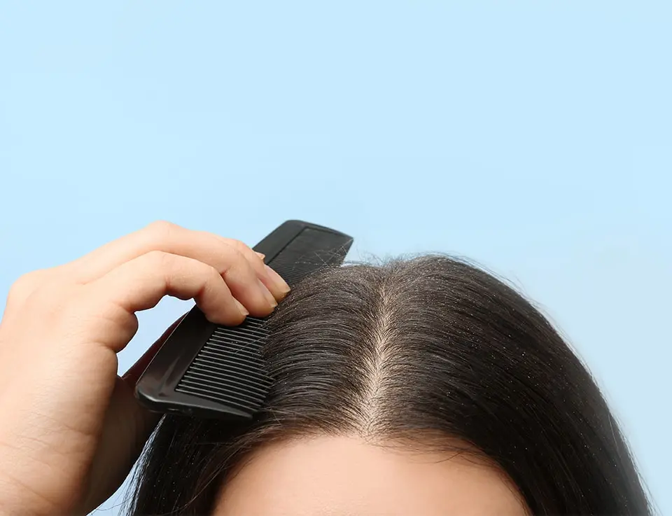 PHS HAIRSCIENCE®️ How to deal with a sensitive scalp