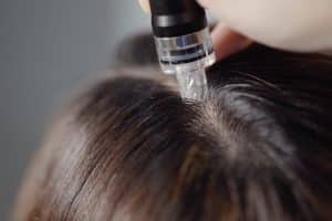 scalp repair treatment that treats 6 common scalp disorders