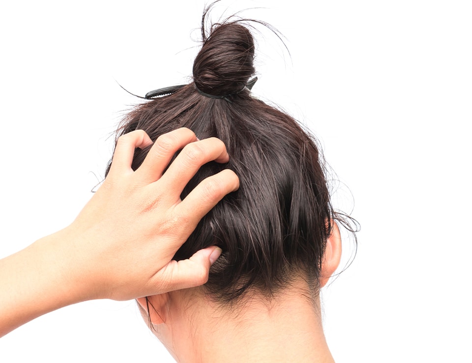 5 FAQs about Dry, Sensitive and Itchy Scalp