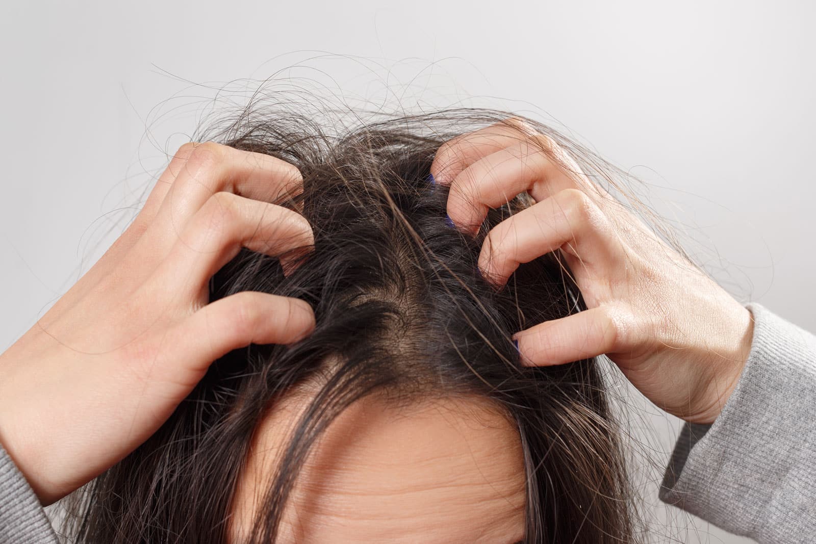 Sensitive Scalp: Causes and Treatment Options